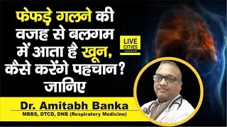 Dr. Amitabh Banka से जानिए, Major Causes of Blood in Cough क्या है ? कैसे होता है इलाज | LiveCities
