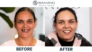 Banning Dental -Transforming Smiles  - Iridenta