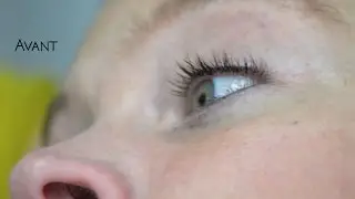 Dermo-pigmentation d'un Eye Liner [DERMALYA]
