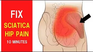 10-Min Hip Pain & Sciatica Relief | Follow-Along Routine to Stop Pain Fast,\ | At-Home Pain Relief
