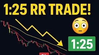 This ONE Setup Gave Me 1:25 RR | Most Powerful EMA Strategy | 10 & 15 EMA STRATEGY| #trading #ema