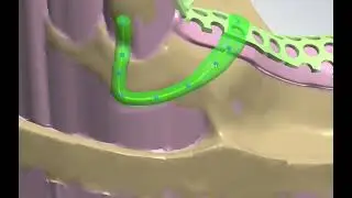 Partial Framework Designㆍ155(YG Dental Lab)