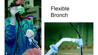 Anesthesia considerations for bronchoscopy, mediastinoscopy, Myasthenia gravis, trach