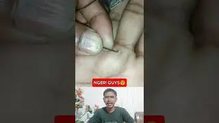 CABUT DURI DI DALAM DAGING #fypシ #short #shorts #feedshorts #splinter
