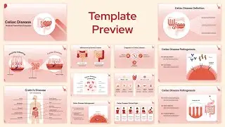 Celiac Disease PowerPoint Presentation Template Preview