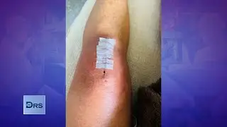 Knee Surgery with the Help of a Robotic Arm Leads to Less Pain?