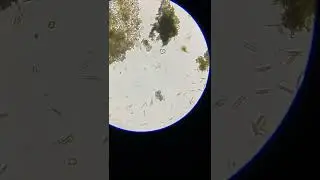 Vorticella under a microscope