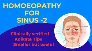 Homoeopathy - Hepar sulph for Sinusitis.