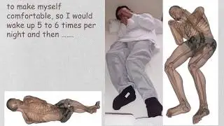 Tommy's Story - 24-hour postural care
