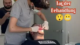 Neue Zähne😳😁 Istanbul Vlog Tag 3 /ITSNICO
