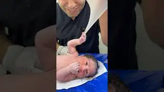#baby VS Doctor