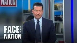 Gottlieb says U.S. has 