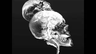 CRRCS049 SUBBASE Skulls and Bones