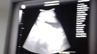 mi primer ultrasonido