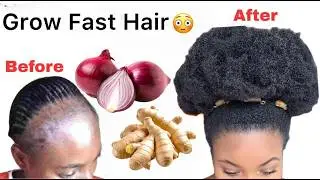 I Used this DIY  ONIONS and GINGER Juice in my hair| Shocking Results 💯🧅
