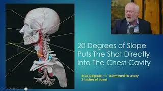 Analysis Solves Kirk Case - Calculating The Shooting Angle (Clip From Peak Prosperity)