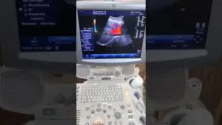 Ge logic P5 (PE) American colour Doppler ultrasound machine.call.03238461745 #viral #foryou #doctor