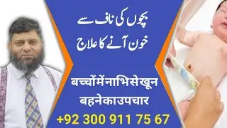 Navel Bleeding of Newborn | Dr. Ahmed Ejaz | Urdu | Hindi | Similia Homeo Clinix | Abbottabad