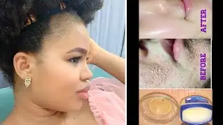 HOW TO USE VASELINE & EGG FOR FACE