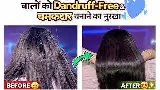 Diy dandruff free + Glass shine hair at home | best results garantee 🔥