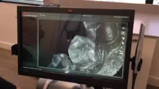 3M True Definition Scanner