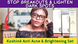 Best Skincare Products to Get Rid of Acne, Hyperpigmentation & Dark Spots (What Actually Works)