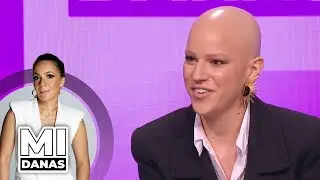 Problem sa alopecijom | Sonja Milosavljević | MI DANAS