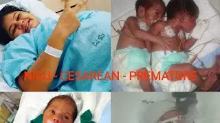 Twin Pregnancy Journey #prematuretwins #nicu  #pregnancyjourney #twinpregnancy #cesarean #nicubaby