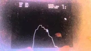 ATARI Lunar Lander game (released 1979) Gaming Classic w/ Moon crash.