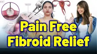 Is It Safe to Treat Fibroids with Radio Frequency Ablation, Laparoscopy, or Ultrasound? | Treatment
