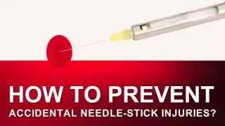 CONTA GUARD from Ronvig Dental