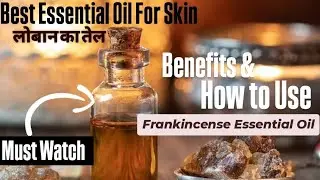 How to use Frankincense Essential Oil | Best essential oil for Skin #facial #winterskincare #dryskin