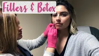 FILLERS || Hit or Miss?! || Amy Ave Makeup