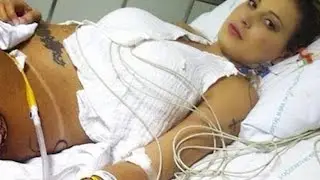 Plastic Surgery Goes Horribly Wrong For Miss BumBum [Graphic]