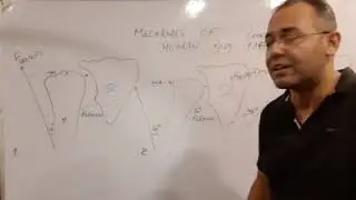 Clinical Significance of Angle of Pull