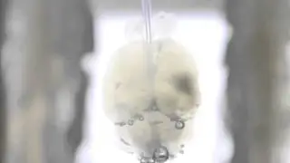 Clearing a mouse brain with the X-CLARITY&trade;