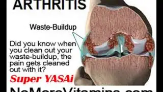 Arthritis Reversal by NoMoreVitamins com