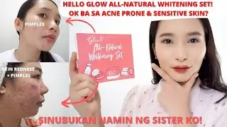 PROS & CONS: HELLO GLOW ALL NATURAL WHITENING SET | GALY GASCON