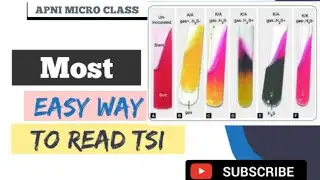 TRiple Sugar Iron | principle | Procedure & Result | IN HINDI