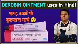Derobin Ointment use in Hindi | दाद, दाग, धब्बे मिटाने की का जबरदस्त दवा | Derobin full Review
