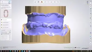 Denture Design with Gnathometer CAD