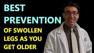 BEST PREVENTION OF SWOLLEN LEGS