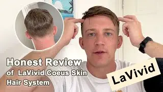 Honest Review of LaVivid Coeus Skin Hair System | Get to know more of Lavivid hair system