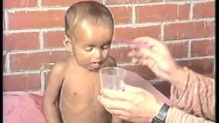 IMCI training video: Exercise G- How to assess a child for diarrhoea