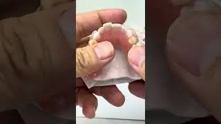 3 clear clasps!