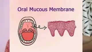 Dealing with mouth ulcers? Check your digestion. #MouthUlcers#Indigestion#OralHealth#DigestiveHealth