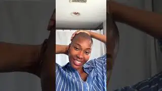 Hello to our new baldies!✨Our CEO and the Baldare team welcome you to the Scalp Squad 🥳 Let us know