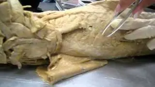Cat Muscles Scalenes Serratus Ventralis