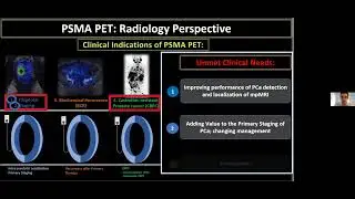 Imaging&rsquo;s Role in the Detection, Diagnosis and Treatment of Prostate Cancer