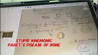Paget&rsquo;s disease stupid mnemonic |#marrow |orthopeadics